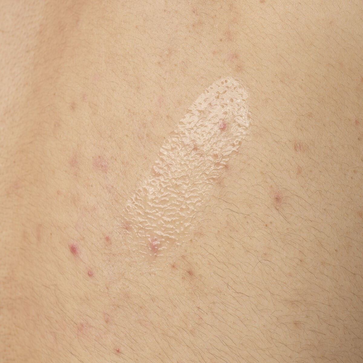 salicylic-acid-0-5-body-serum-i1 ORD-salicylic-acid-05-body-240ml-application.jpg