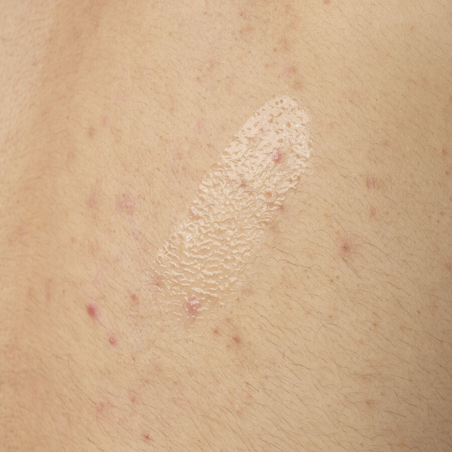 salicylic-acid-0-5-body-serum-i1 ORD-salicylic-acid-05-body-240ml-application.jpg