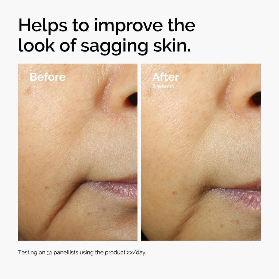 caffeine-3-escin-1-face-serum-y5 ord-caffeine-3pct-escin-1pct-face-serum-before-after-sagging.jpg