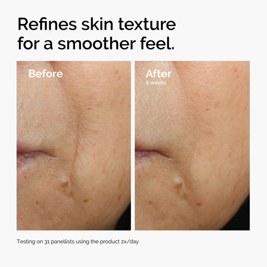 caffeine-3-escin-1-face-serum-y5 ord-caffeine-3pct-escin-1pct-face-serum-before-after-texture.jpg
