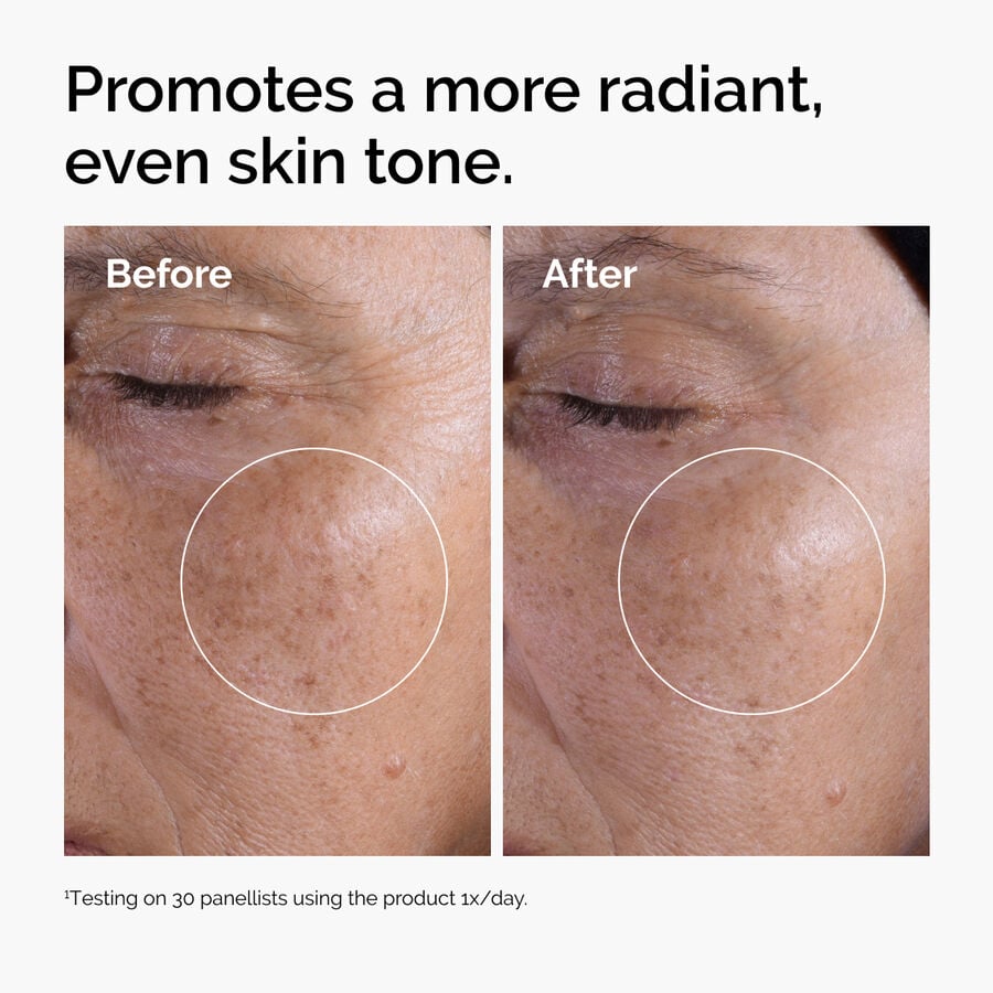 glycolic-acid-7-exfoliating-toner-j3 ord-glycolic-before-after-radiance.jpg