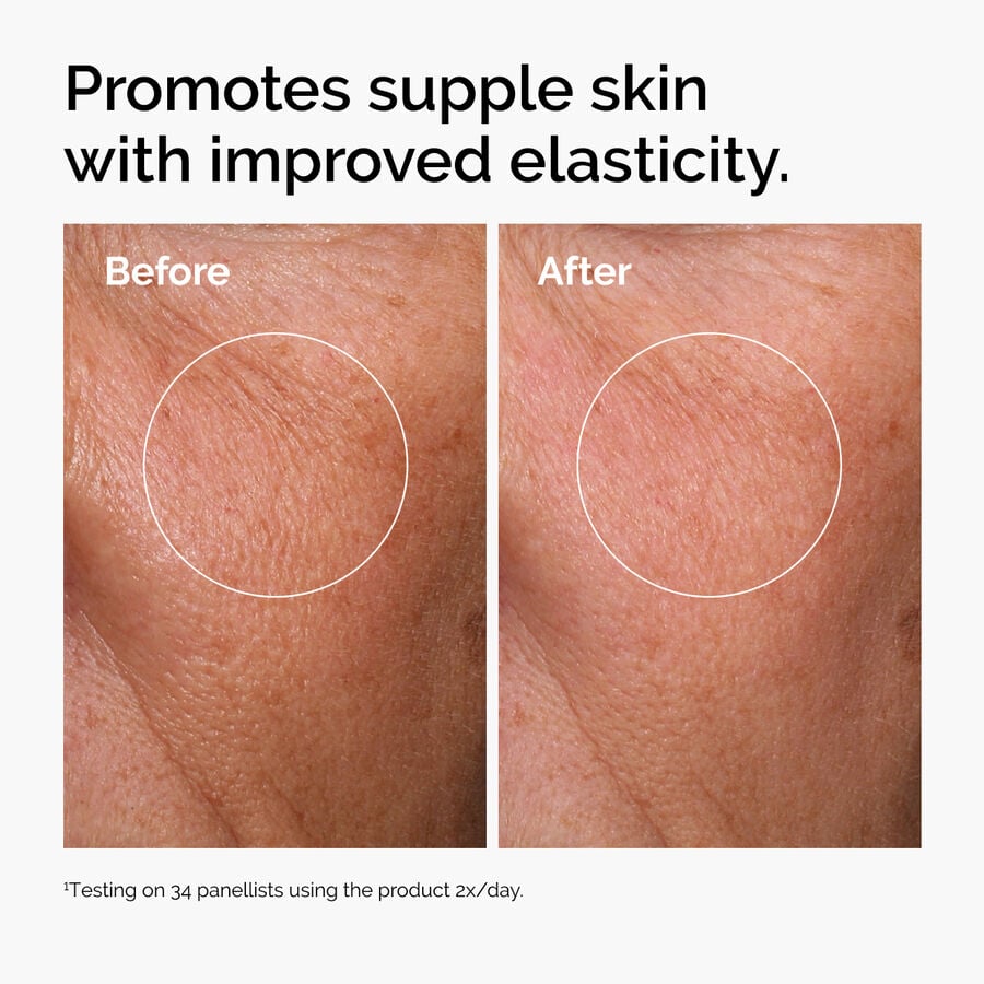 hyaluronic-acid-2-b5-with-ceramides-w6 ord-hyaluronic-acid-2pct-b5-hydrating-serum-before-after-elasticity.jpg