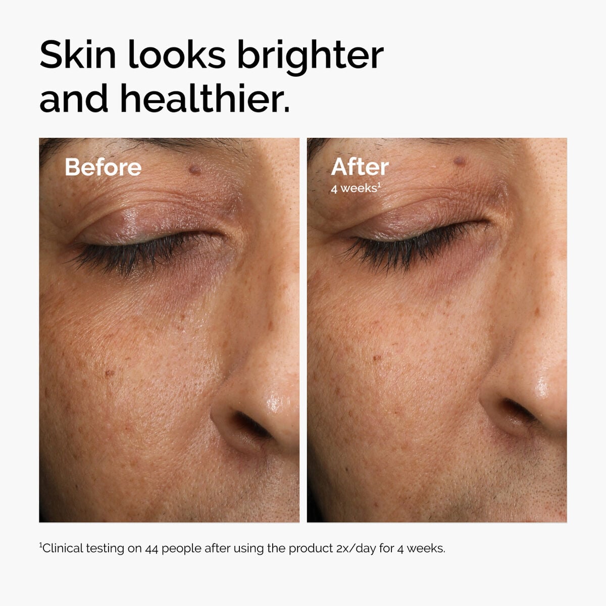 multi-antioxidant-radiance-serum-b3 ord-mars-before-after-healthy.jpg