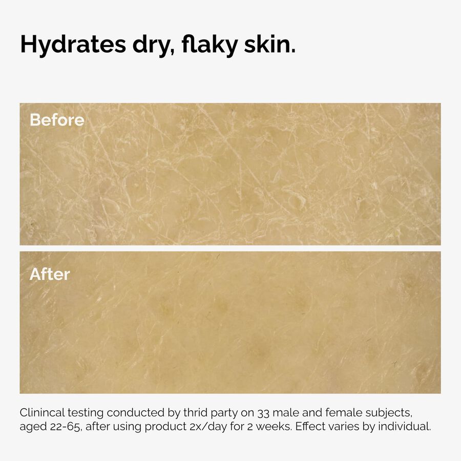 the-body-care-collection-d8 ord-natural-moisturizing-factors-inulin-body-before-after-graphic-02.jpg
