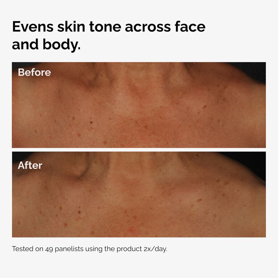 the-body-care-collection-d8 ord-niacinamide-face-body-serum-before-after-even-tone-graphic.jpg