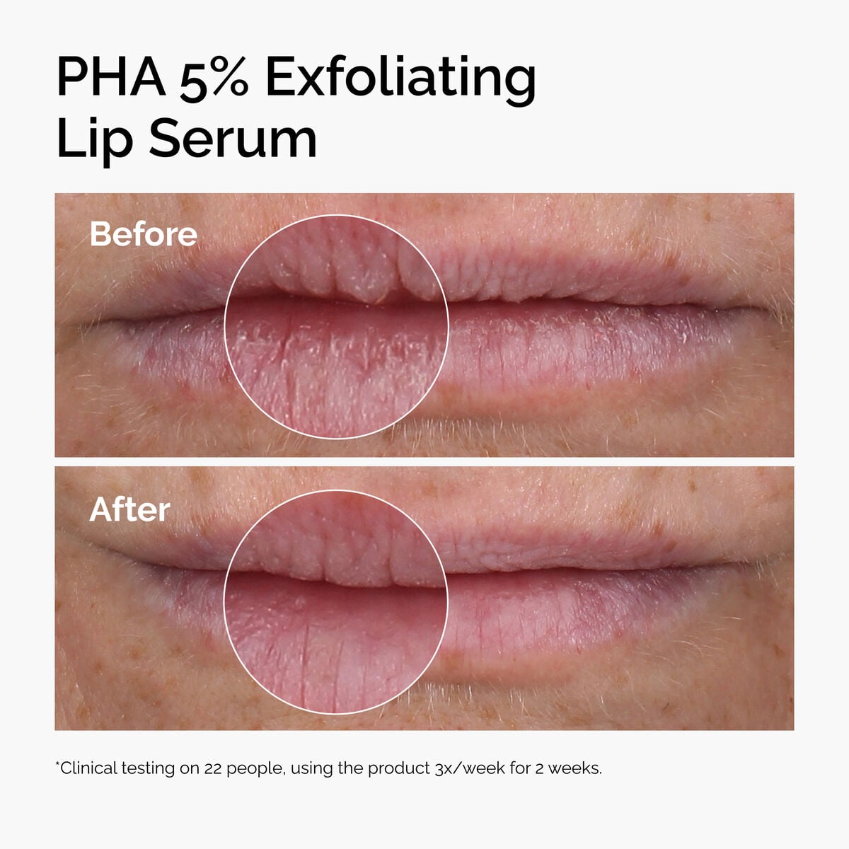 pha-5-exfoliating-lip-serum-m8 ord-pha-5pct-lip-exfoliating-serum-before-after.jpg