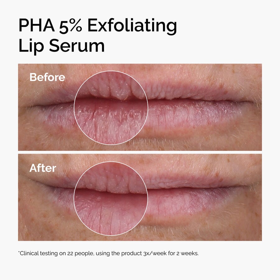 pha-5-exfoliating-lip-serum-m8 ord-pha-5pct-lip-exfoliating-serum-before-after.jpg
