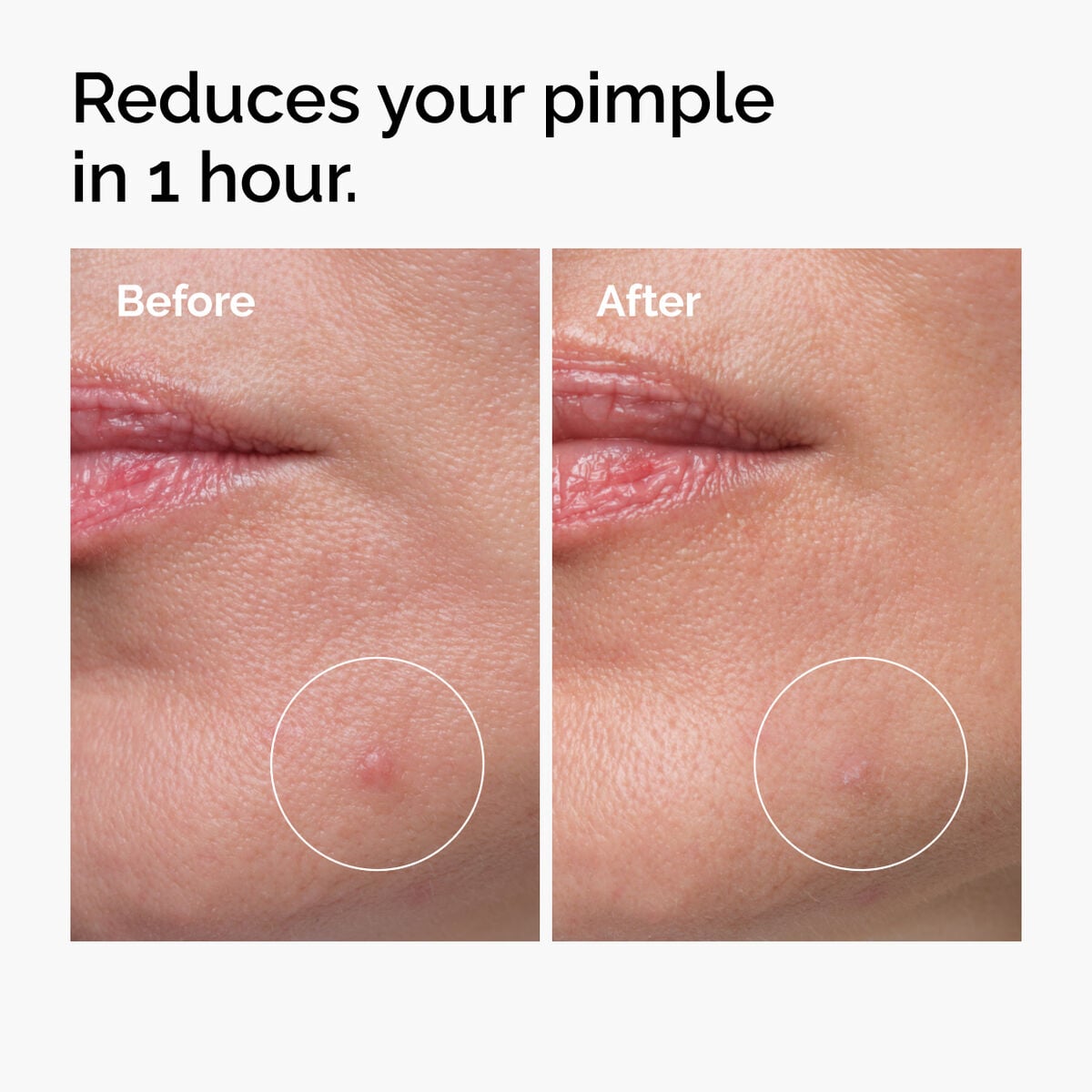 sulfur-10-powder-to-cream-concentrate-j4 ord-sulfur-10pct-powder-to-cream-concentrate-before-after-NA.jpg