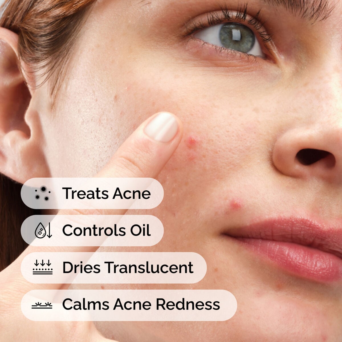 sulfur-10-powder-to-cream-concentrate-j4 ord-sulfur-10pct-powder-to-cream-concentrate-model-application-with-benefits-acne.jpg